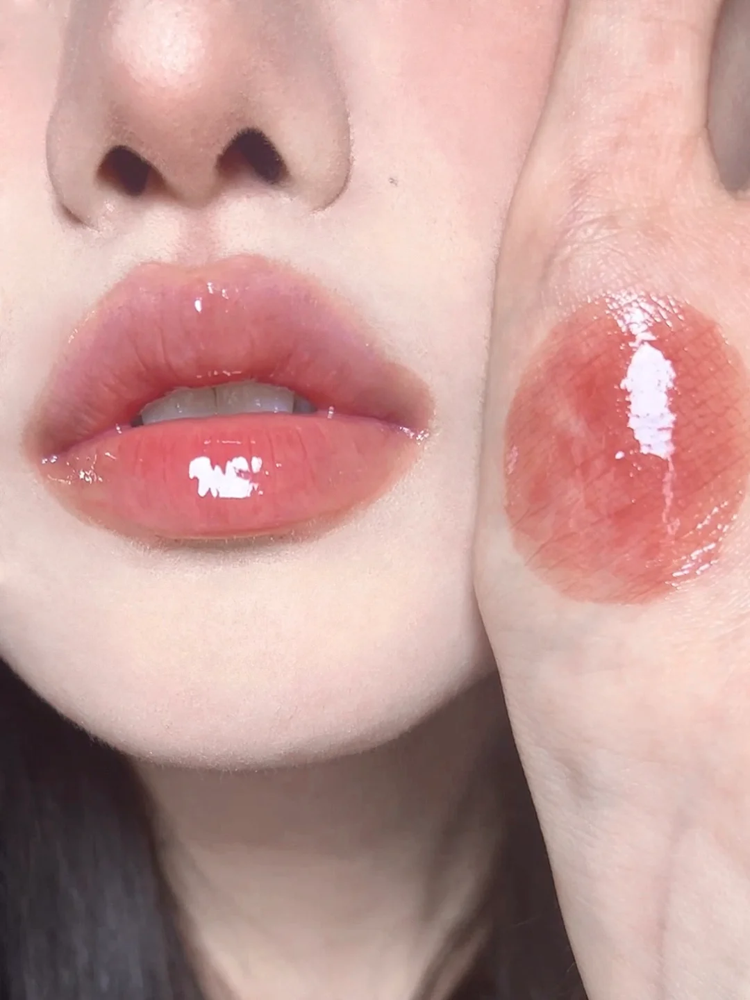色就爱手机版大腿外侧很痒一抓就抓出青紫色-第2张图片-太平洋在线下载